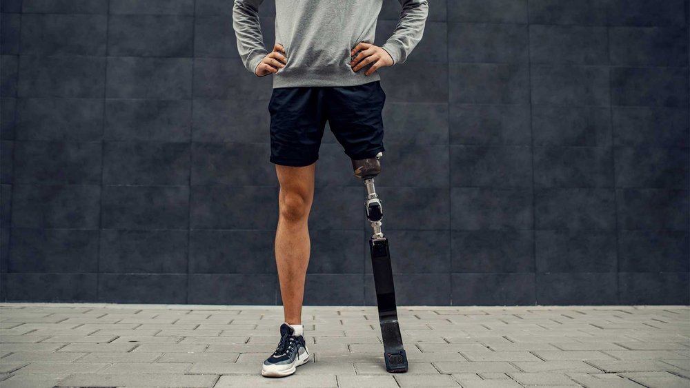 A man with a prosthetic leg stands with hands on his hips against a dark wall.
