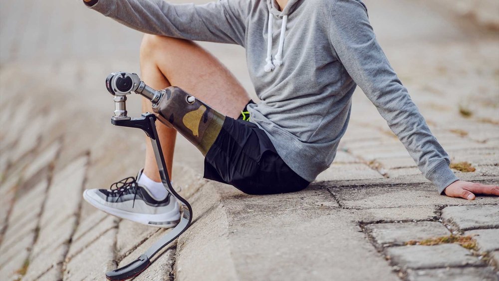 A close-up shows a man with a camouflage-patterned prosthetic leg sitting on a curb.