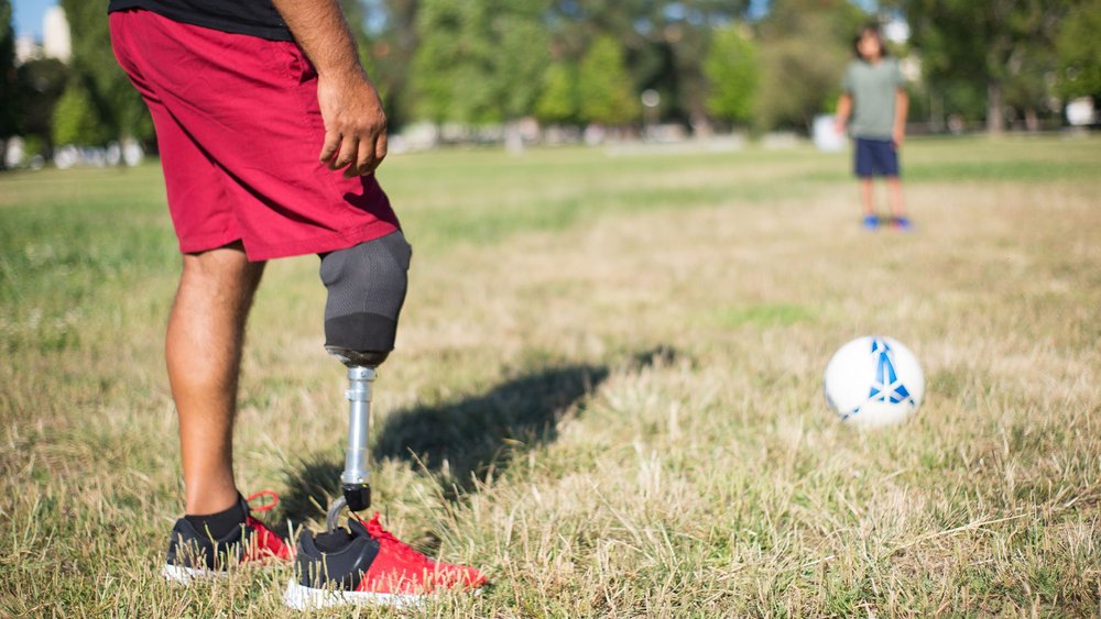 A man with a prosthetic leg stands on grass near a soccer ball as a child watches.
