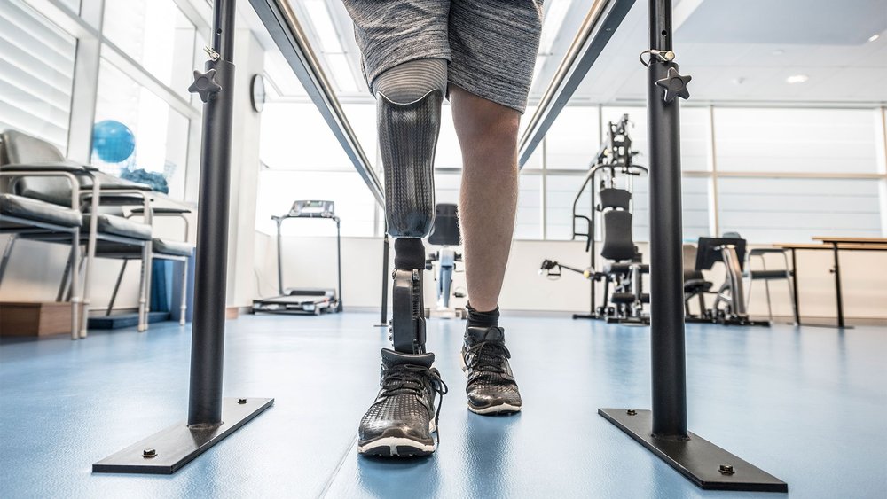 A person with a leg prosthesis walks between parallel bars in a rehabilitation gym.