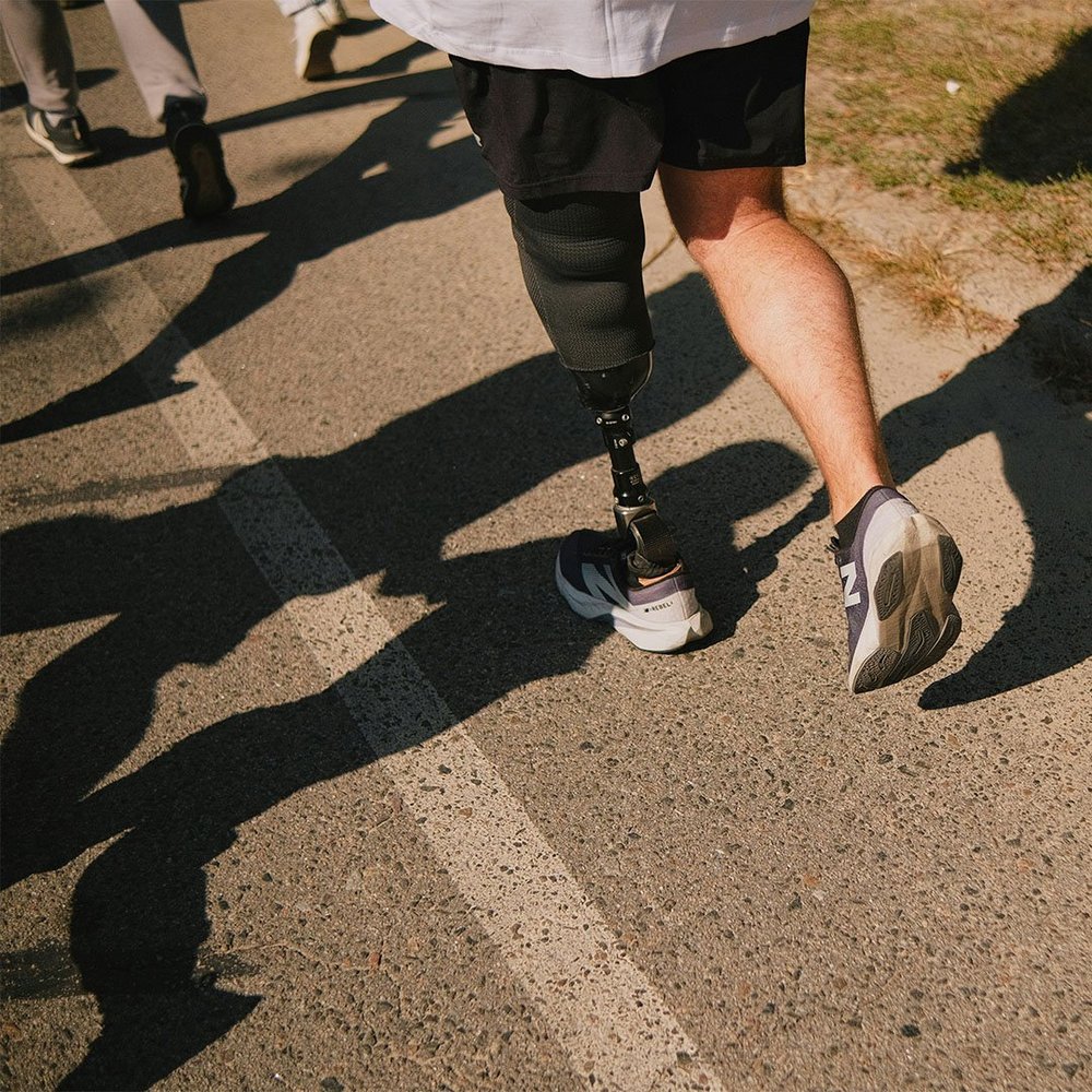 A runner's legs are shown from behind, one fitted with a running blade prosthesis.